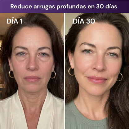 Serum-Gel AntiAge | Volve a sentirte vos misma
