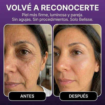 Serum-Gel AntiAge | Volve a sentirte vos misma.